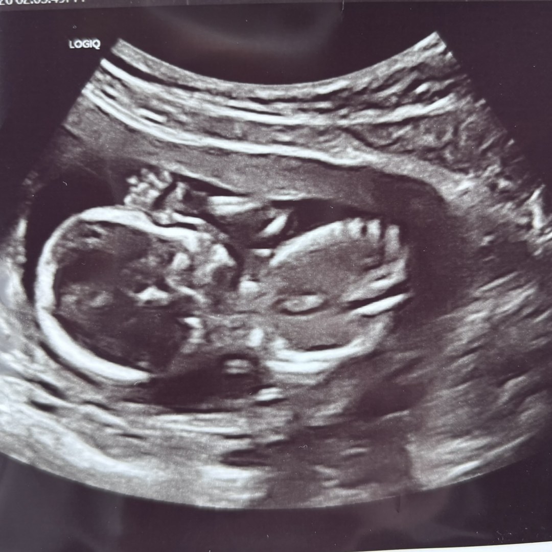 Photo shared by Nicole for their Babylist baby registry.