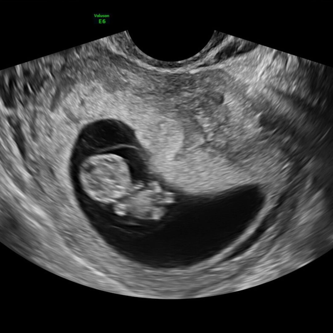 Photo shared by Ashley for their Babylist baby registry.