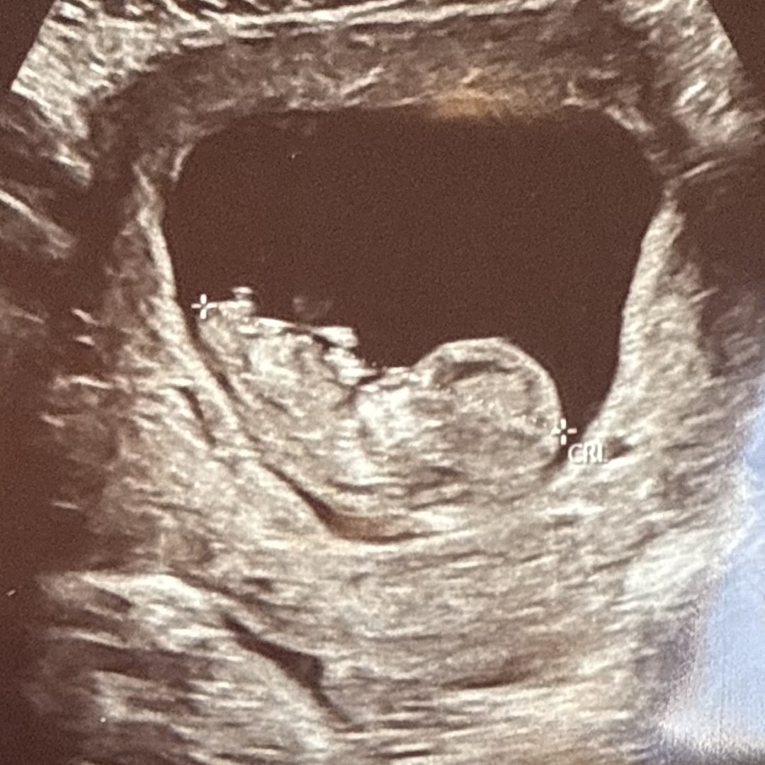 Photo shared by Tailor for their Babylist baby registry.