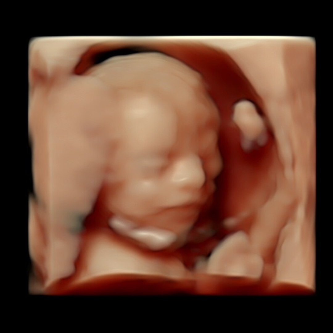 Photo shared by Becca for their Babylist baby registry.