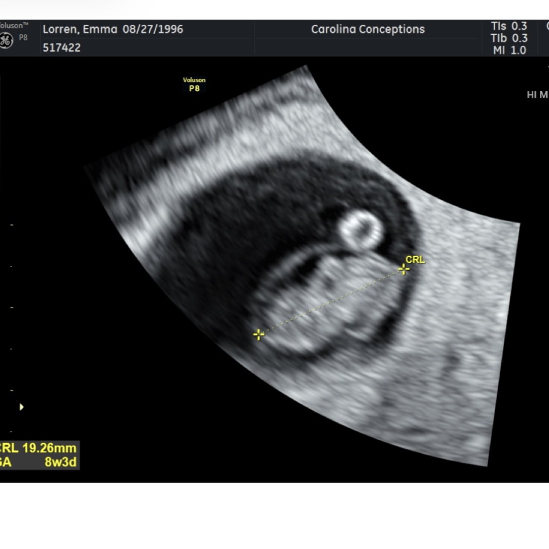 Photo shared by Emma for their Babylist baby registry.