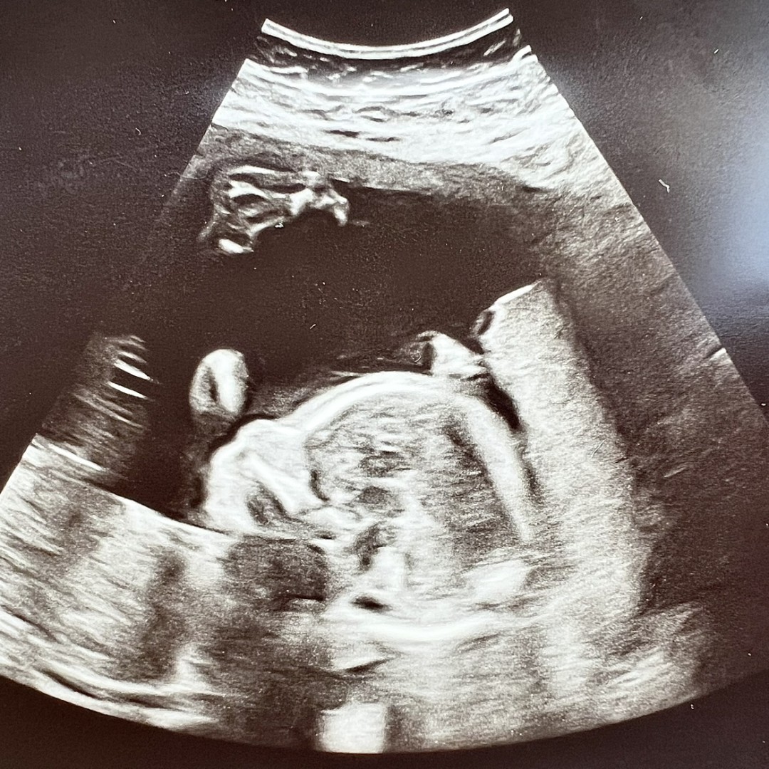 Photo shared by Jess for their Babylist baby registry.