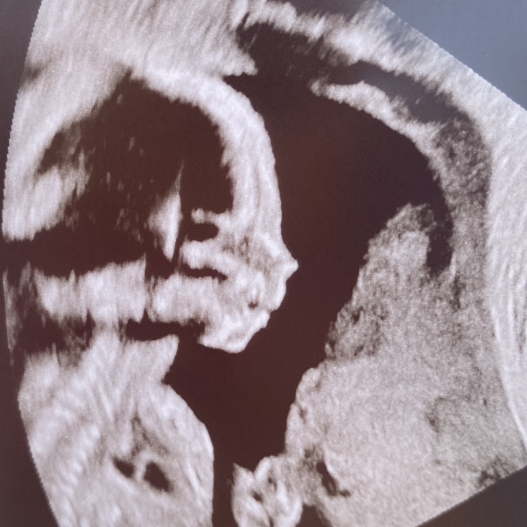 Photo shared by Heidi for their Babylist baby registry.