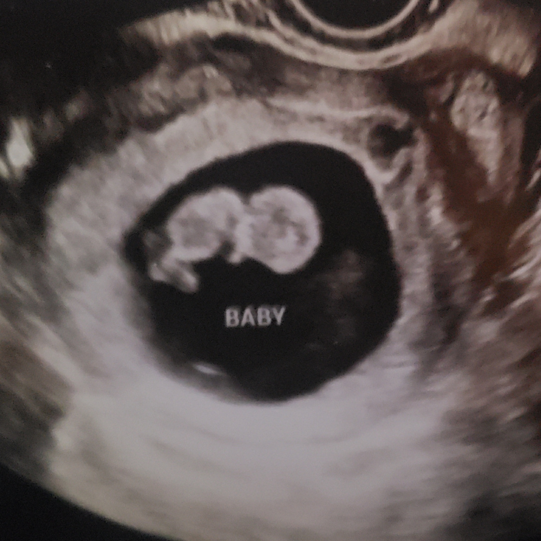 Photo shared by Valerie for their Babylist baby registry.