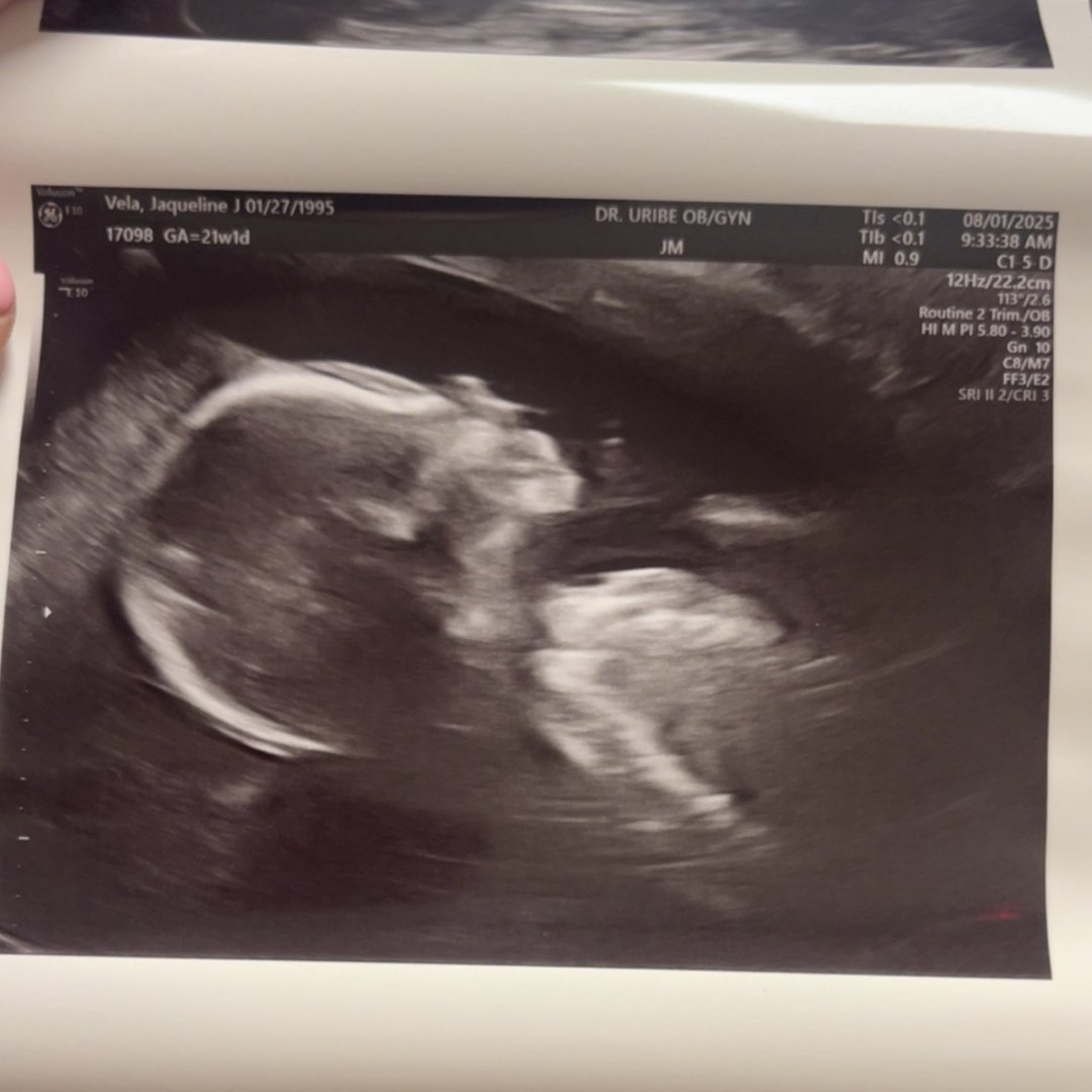Photo shared by Jaqueline for their Babylist baby registry.