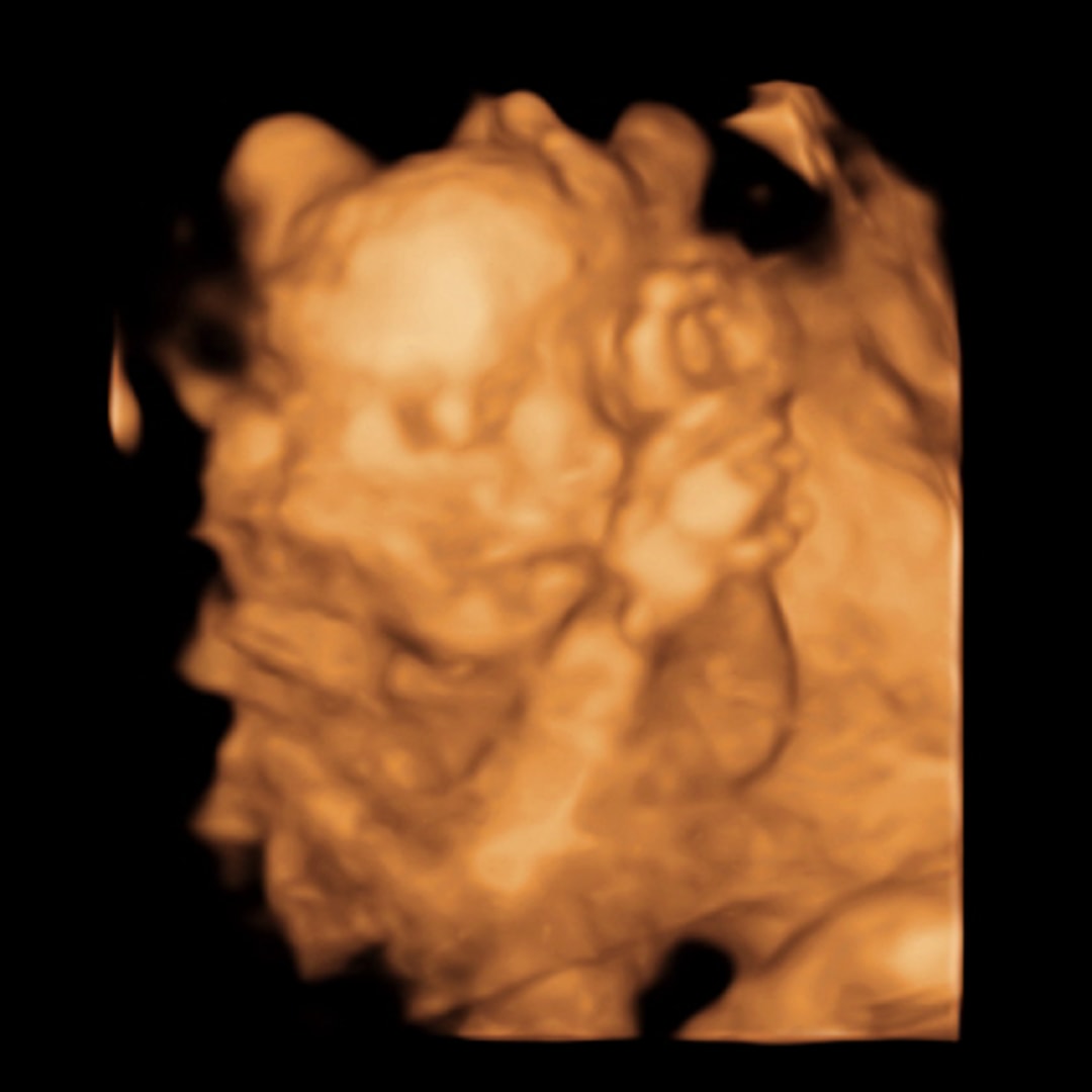 Photo shared by Amy for their Babylist baby registry.