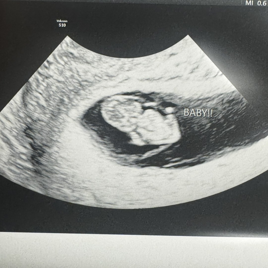 Photo shared by Keysha for their Babylist baby registry.