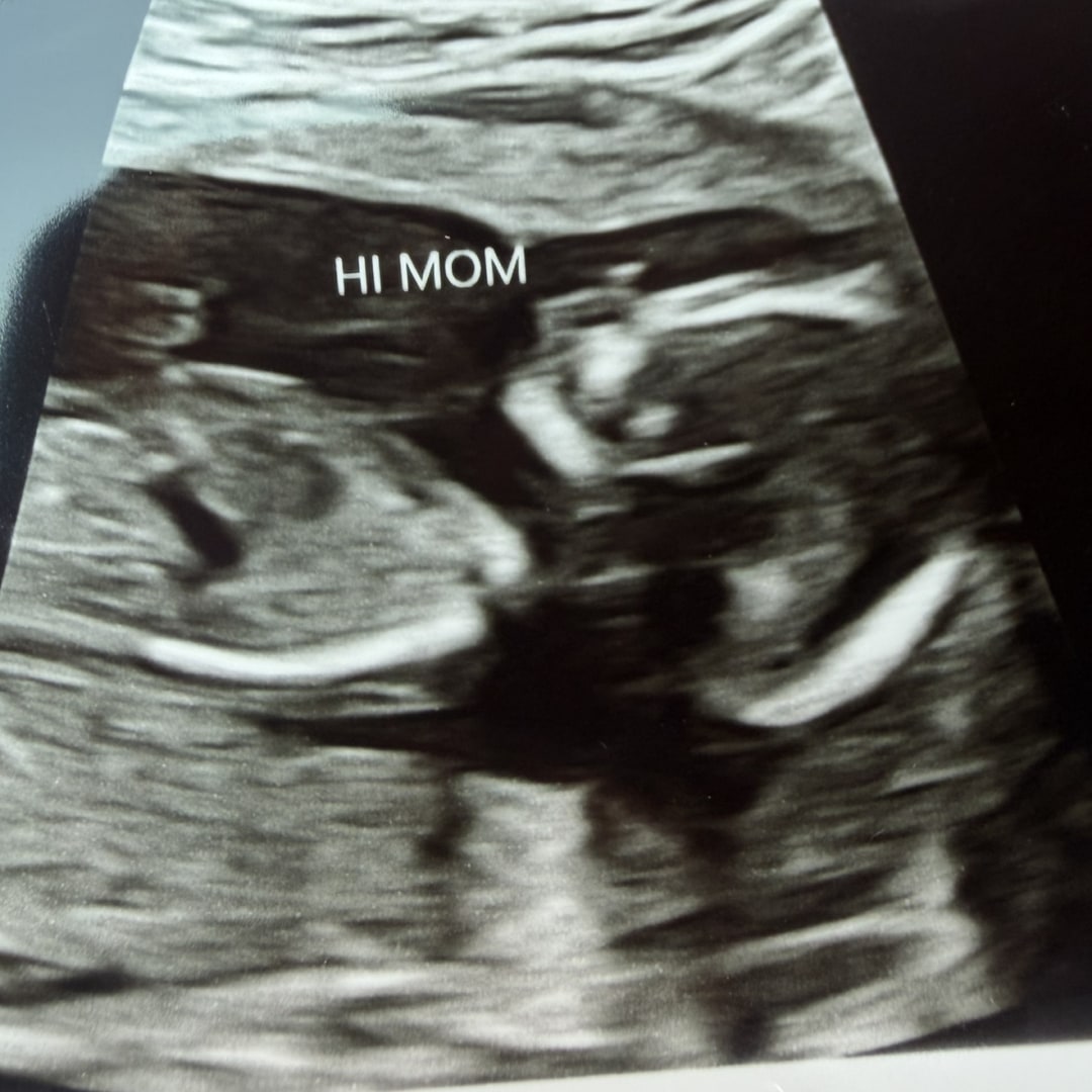 Photo shared by Carina for their Babylist baby registry.