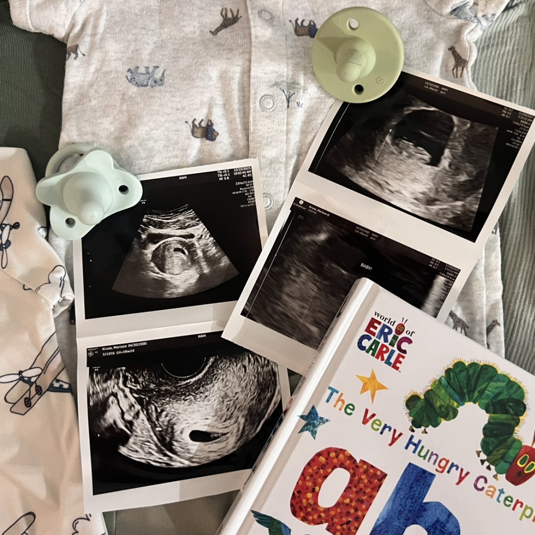 Photo shared by Marissa for their Babylist baby registry.