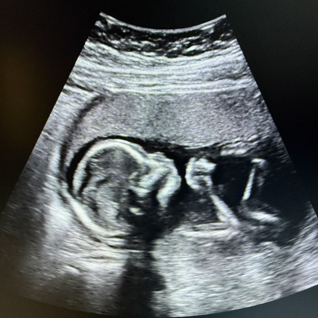 Photo shared by Samantha for their Babylist baby registry.