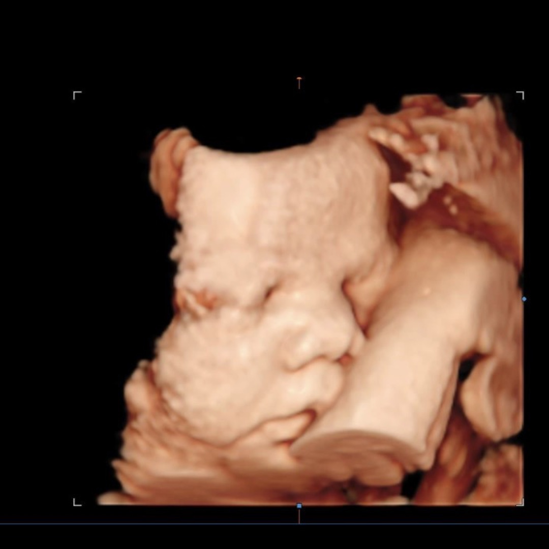 Photo shared by Claudia for their Babylist baby registry.