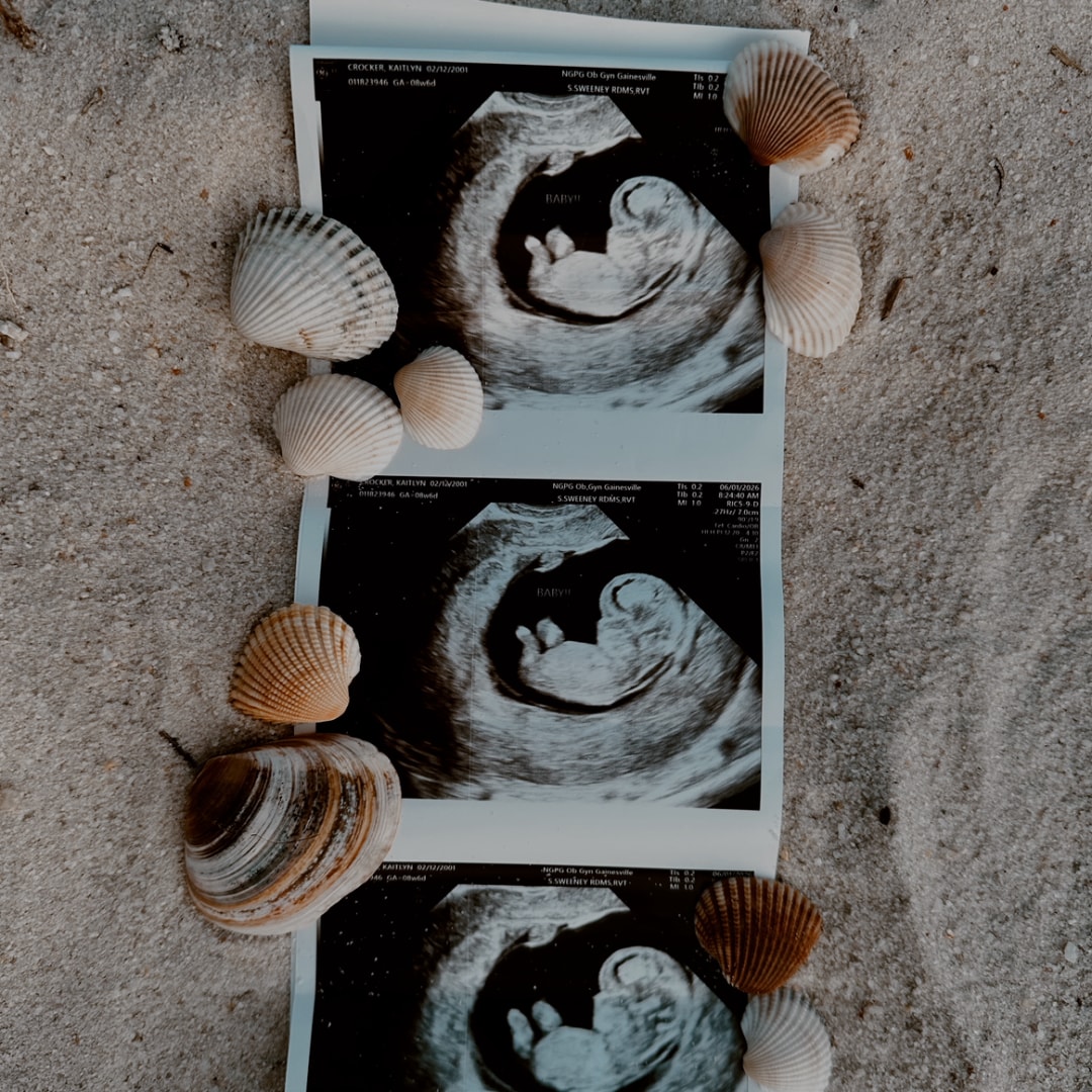 Photo shared by Kaitlyn for their Babylist baby registry.