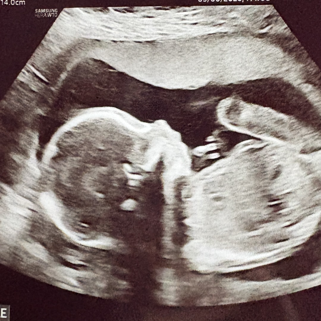 Photo shared by Madison for their Babylist baby registry.