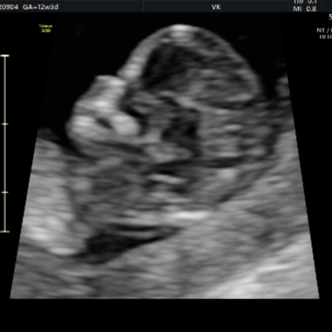 Photo shared by Kayla for their Babylist baby registry.