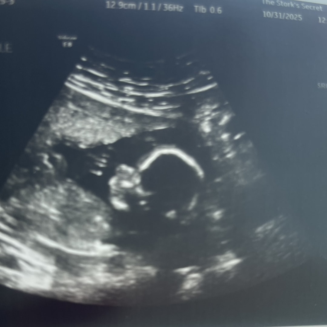 Photo shared by Emma for their Babylist baby registry.