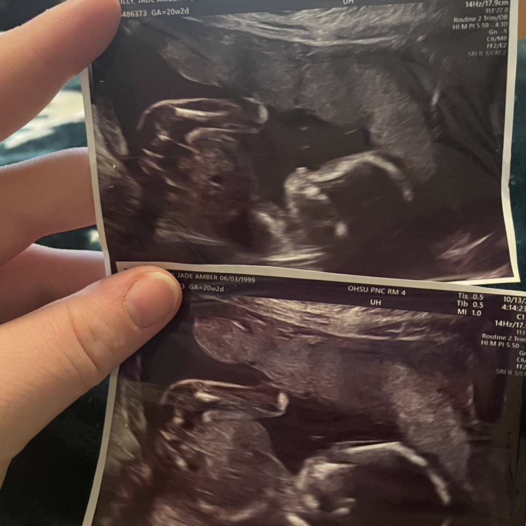 Photo shared by Jade for their Babylist baby registry.