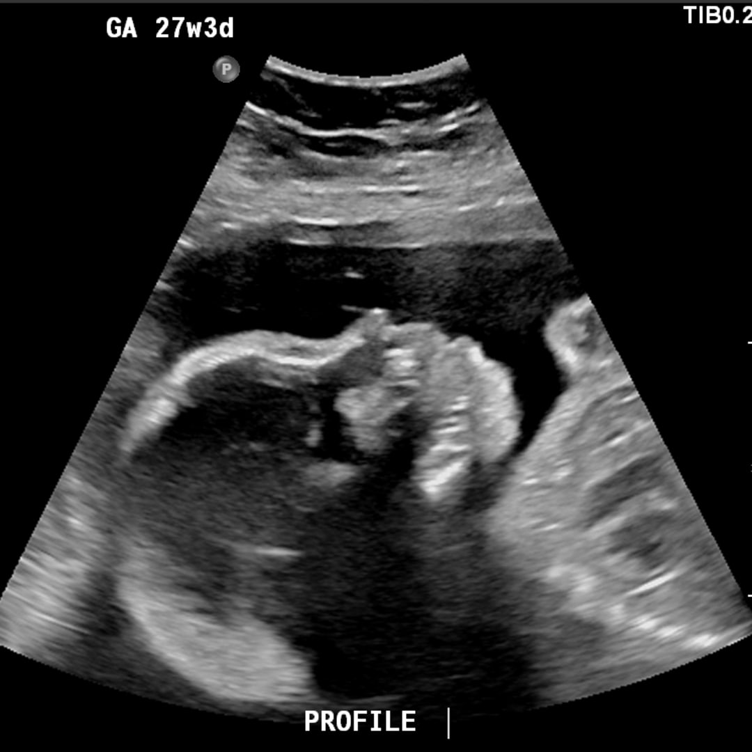 Photo shared by Kaela for their Babylist baby registry.