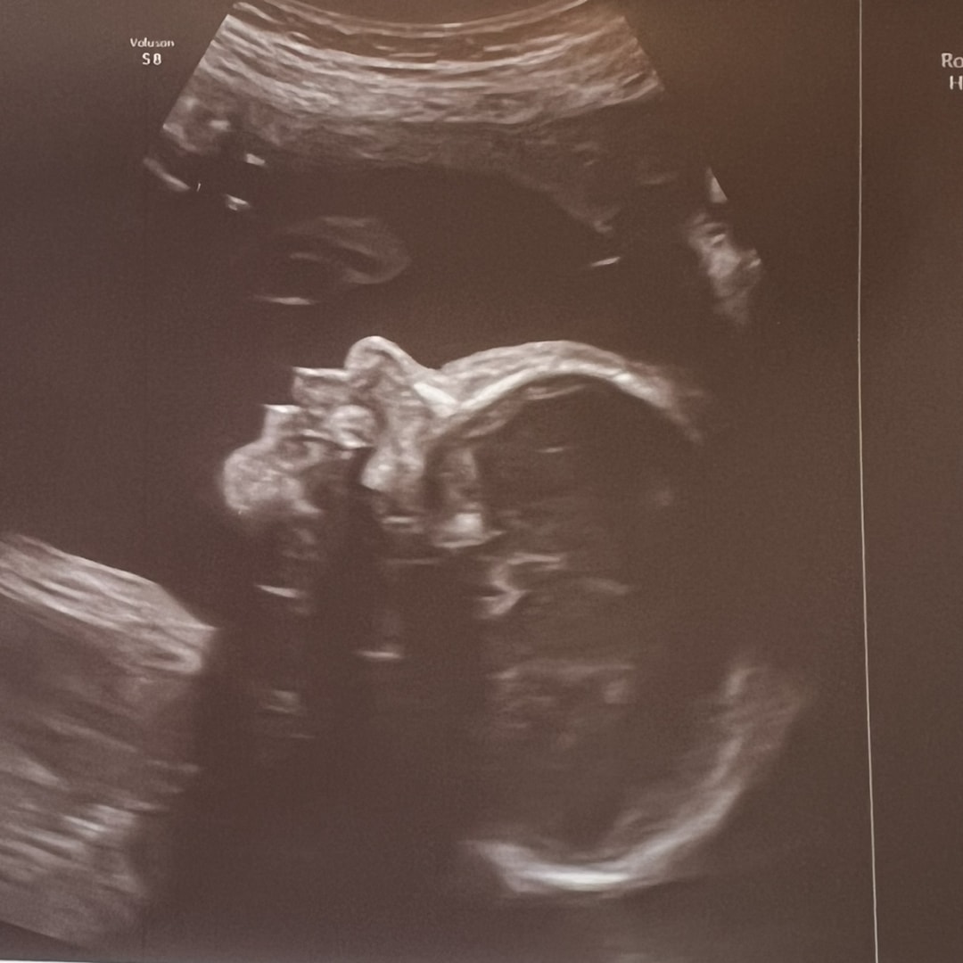 Photo shared by DeAnna for their Babylist baby registry.