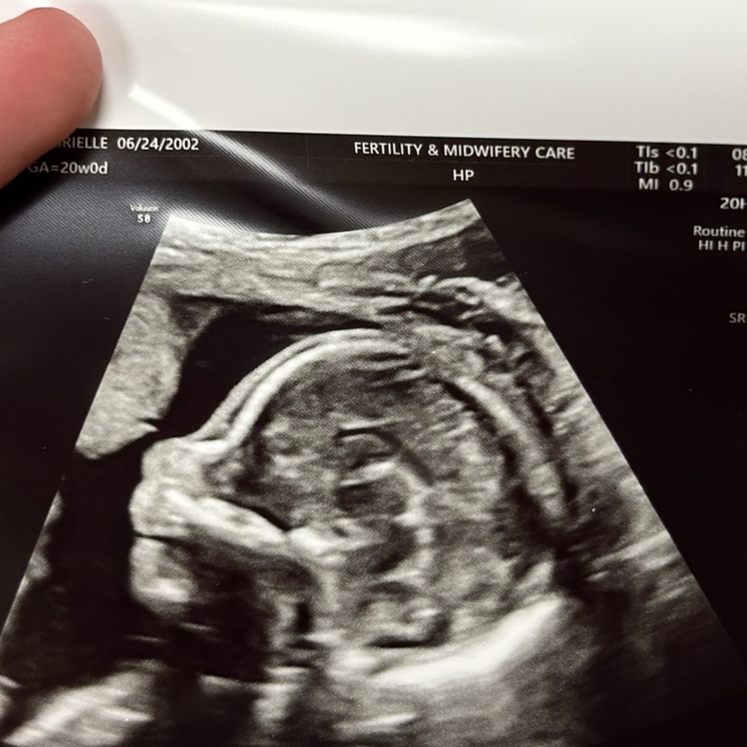 Photo shared by Gabrielle for their Babylist baby registry.