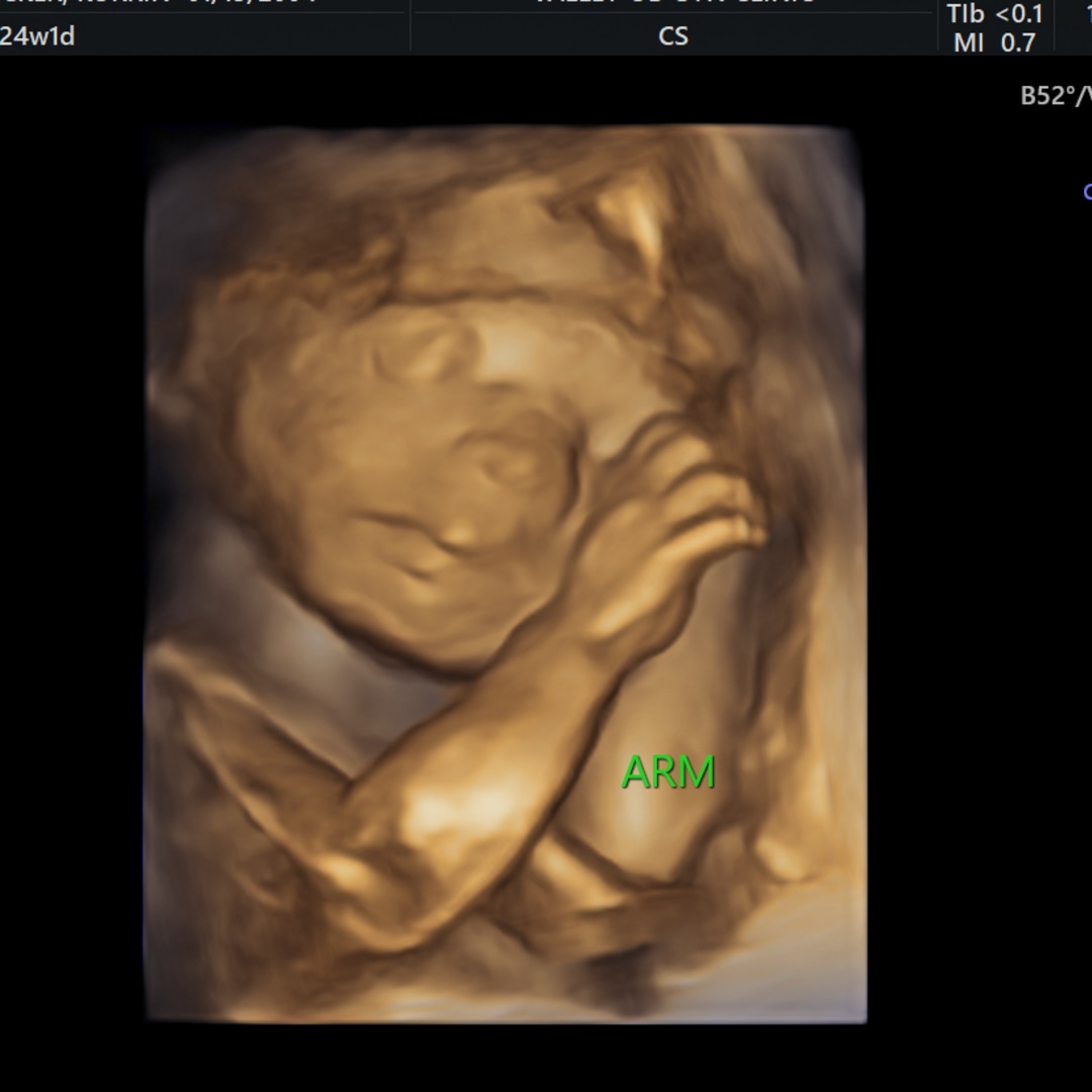 Photo shared by Korrin for their Babylist baby registry.