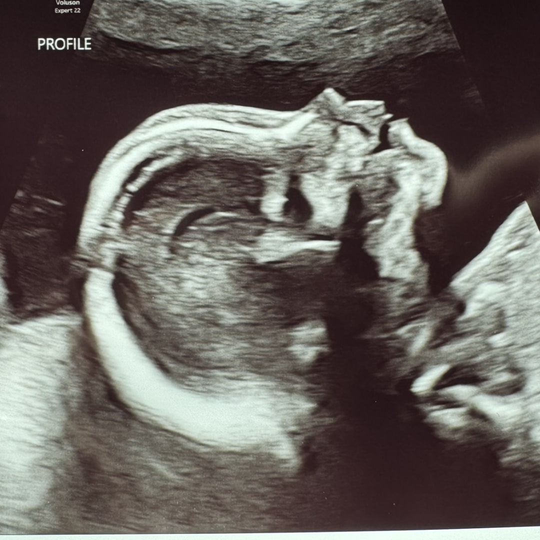 Photo shared by Kendall for their Babylist baby registry.