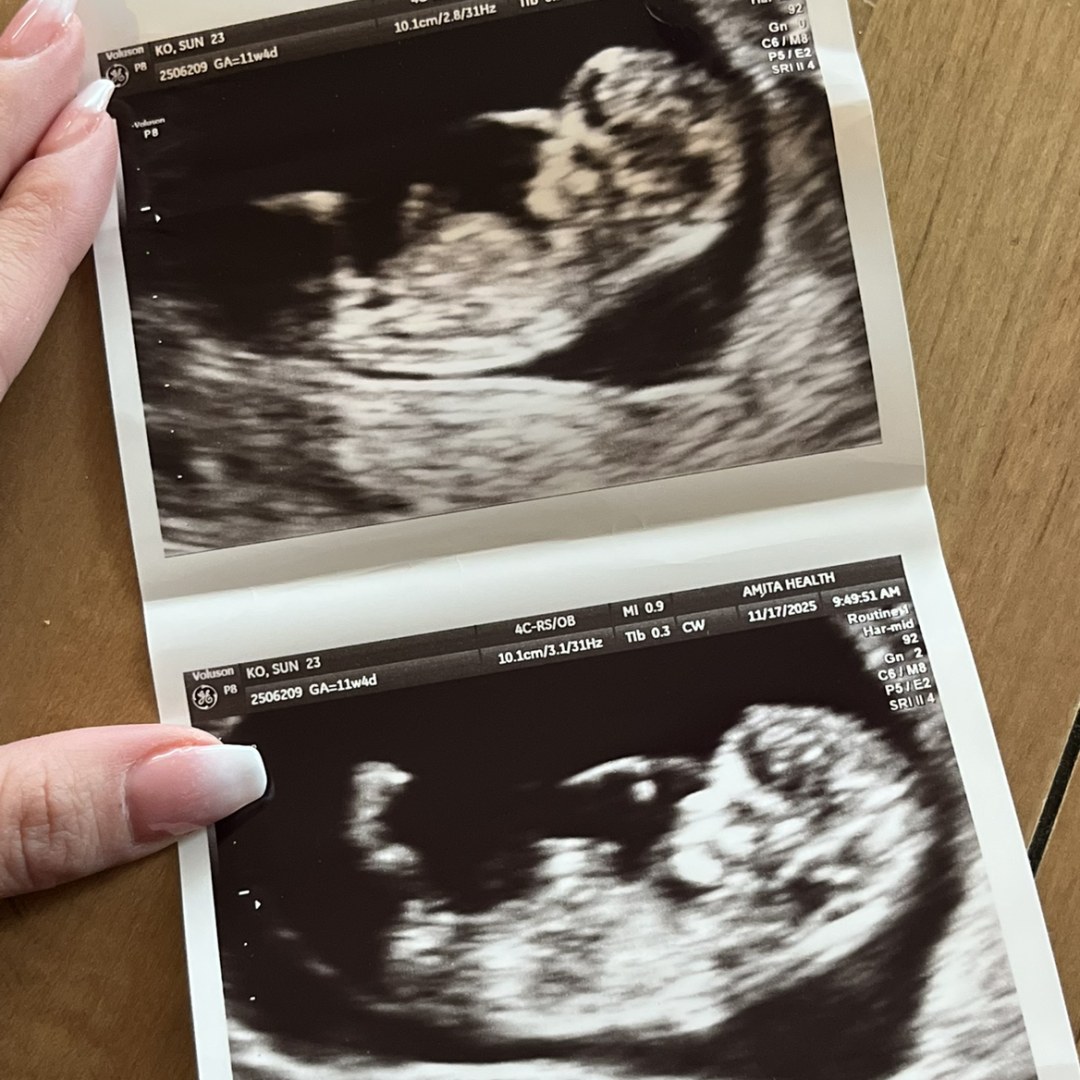 Photo shared by Sunny for their Babylist baby registry.