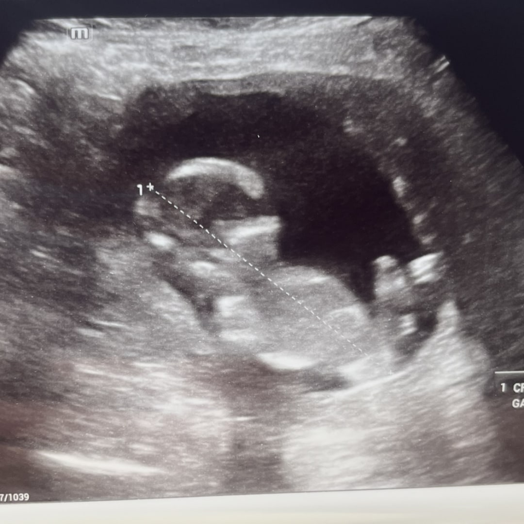 Photo shared by Rebecca for their Babylist baby registry.