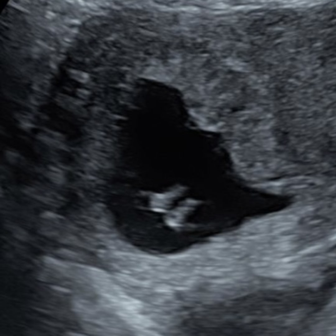 Photo shared by Raelynn for their Babylist baby registry.