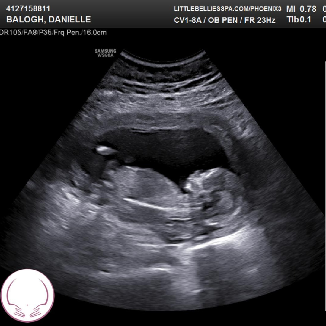 Photo shared by Danielle for their Babylist baby registry.