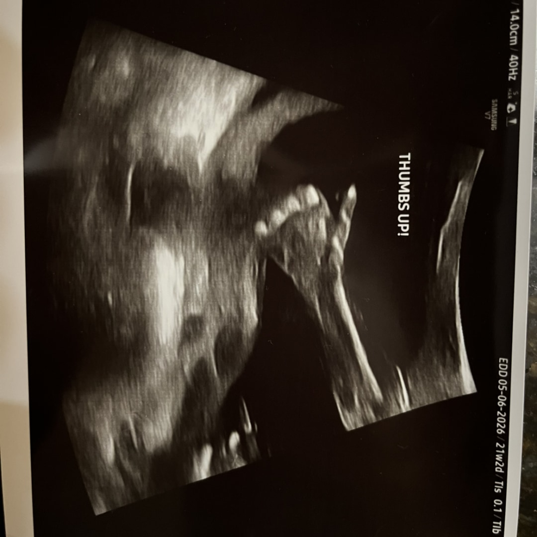 Photo shared by Kelsey for their Babylist baby registry.