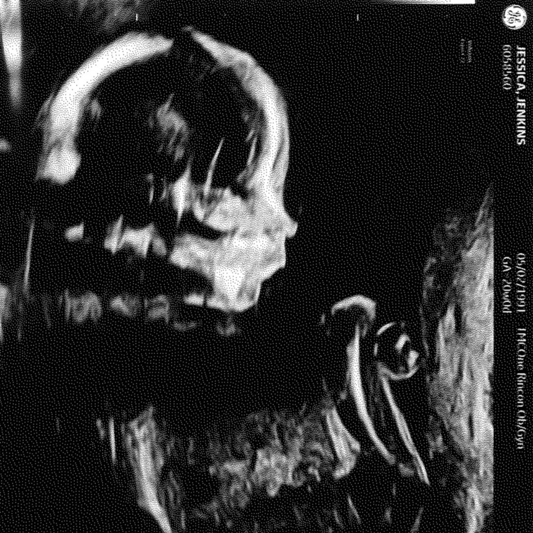 Photo shared by Jess for their Babylist baby registry.