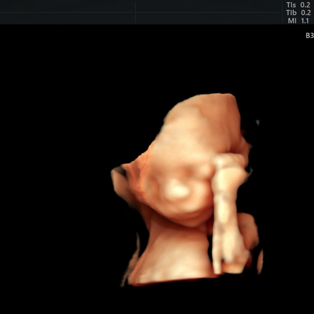 Photo shared by Gracie for their Babylist baby registry.