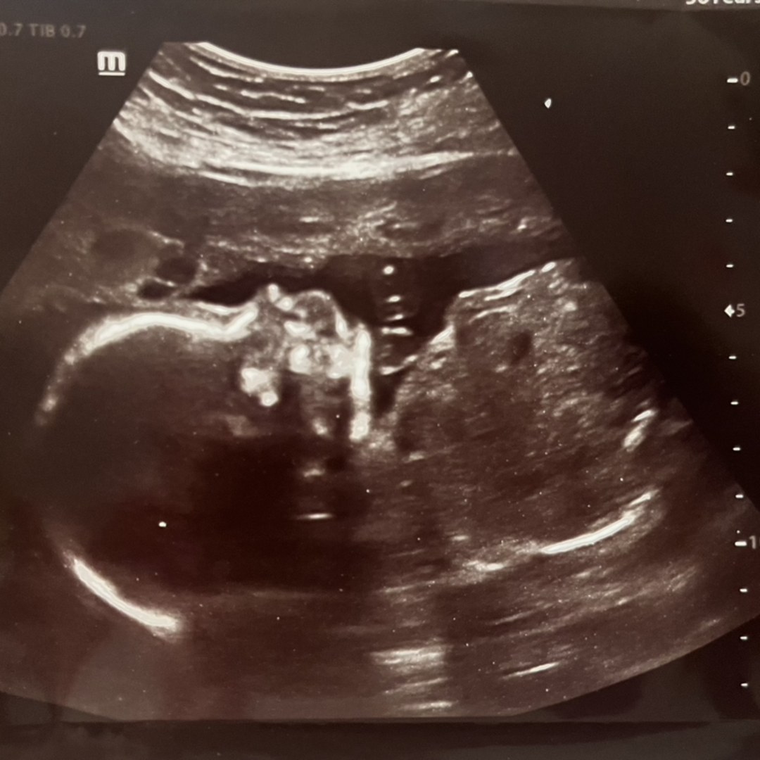 Photo shared by Sarah for their Babylist baby registry.