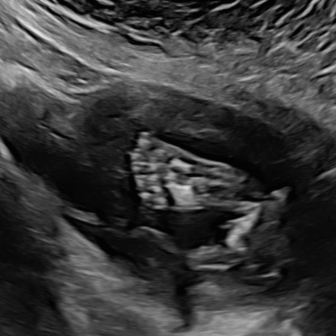 Photo shared by Kristina for their Babylist baby registry.