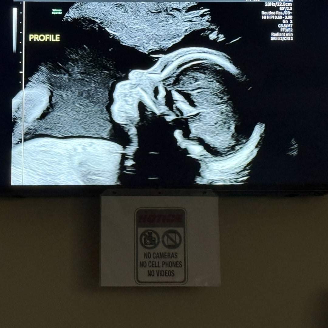 Photo shared by Courtney for their Babylist baby registry.