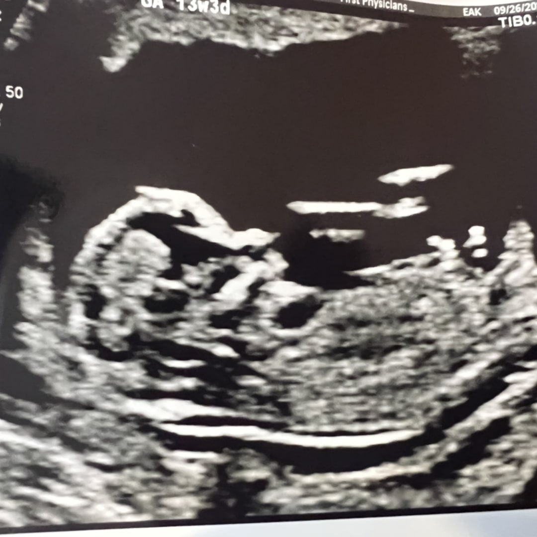 Photo shared by Kimberly for their Babylist baby registry.