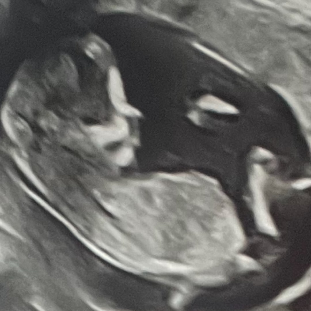 Photo shared by Drew for their Babylist baby registry.