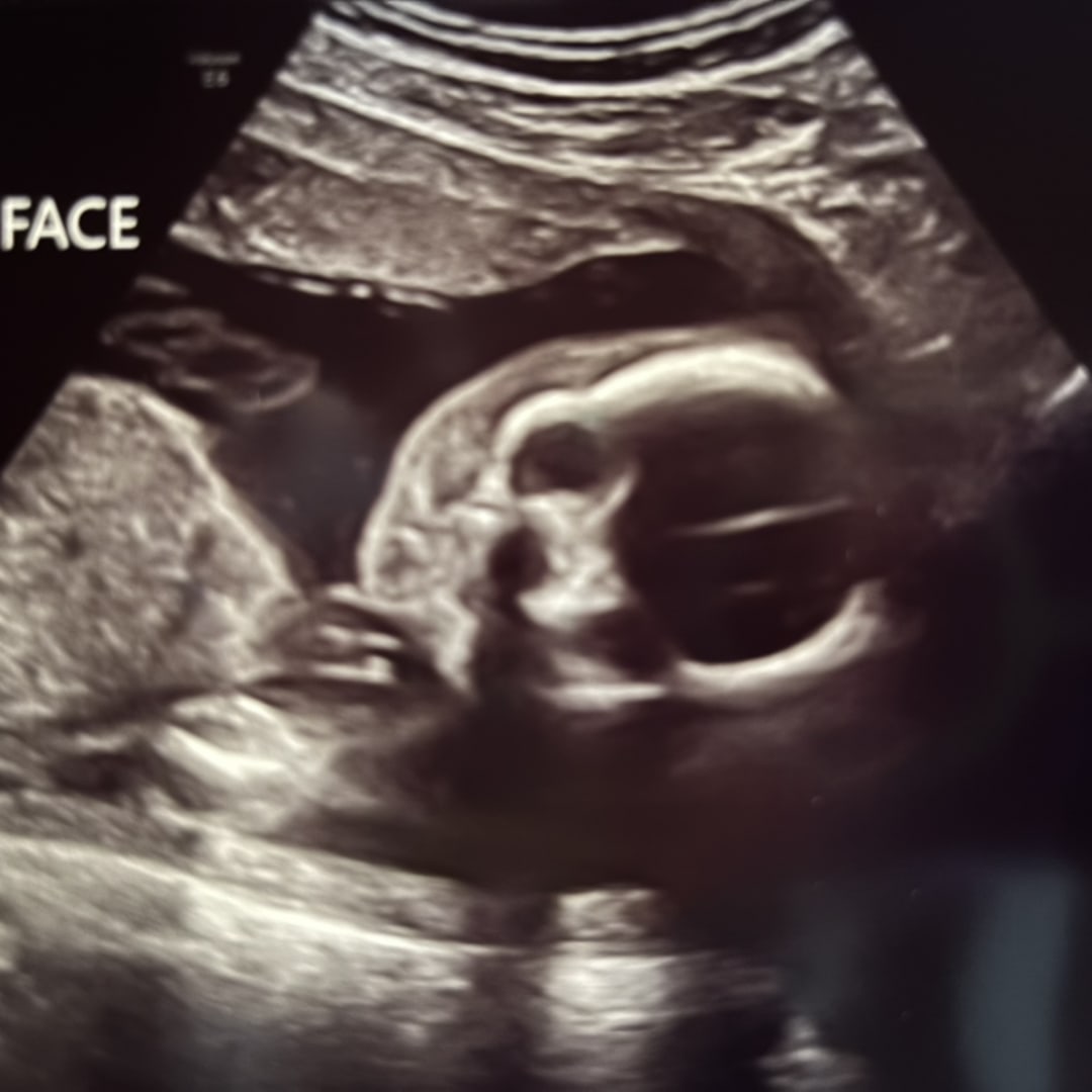 Photo shared by Sarah Nell for their Babylist baby registry.