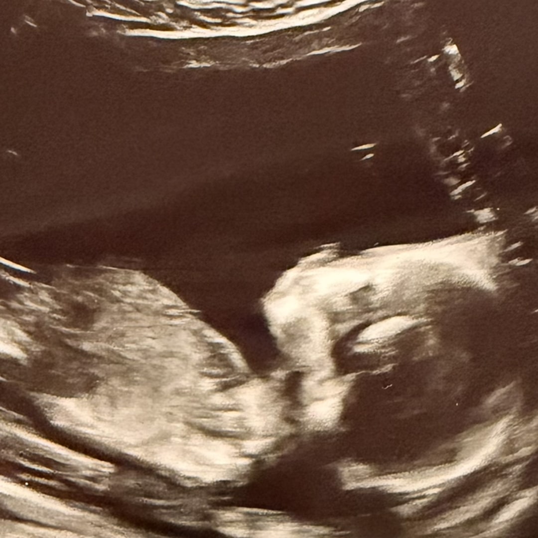 Photo shared by Raven for their Babylist baby registry.