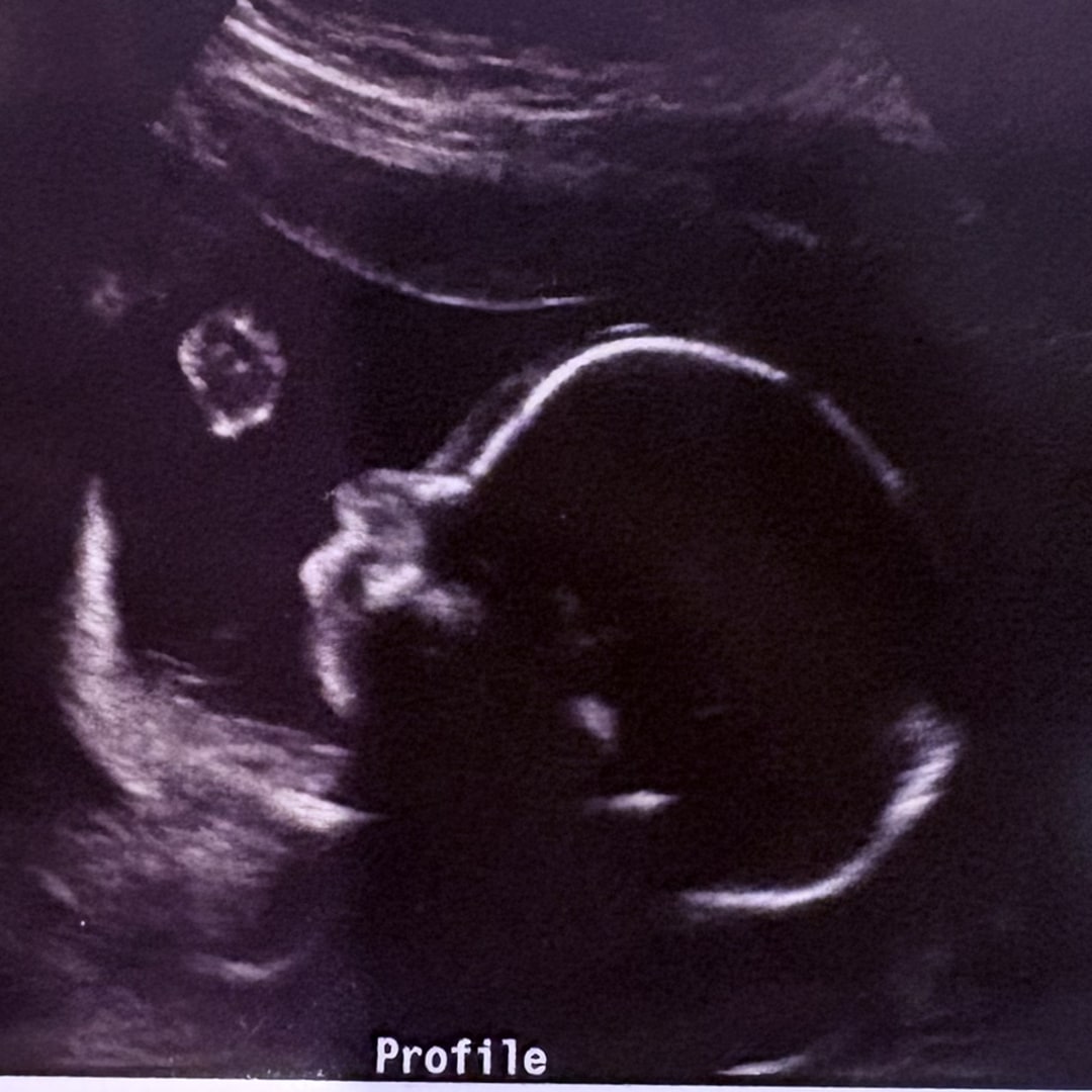 Photo shared by Capri for their Babylist baby registry.