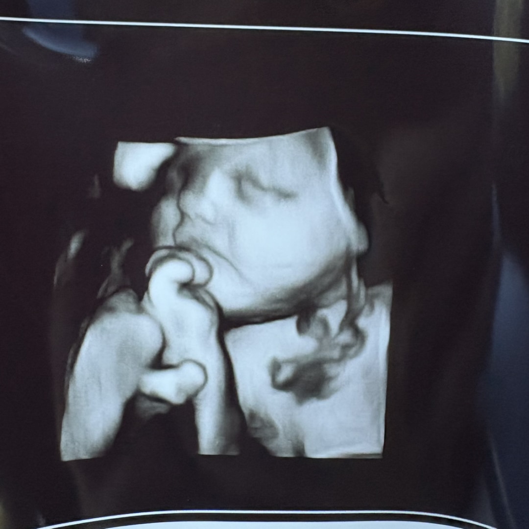Photo shared by Alexis for their Babylist baby registry.