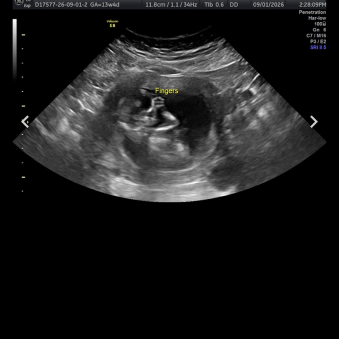 Photo shared by Amelia for their Babylist baby registry.