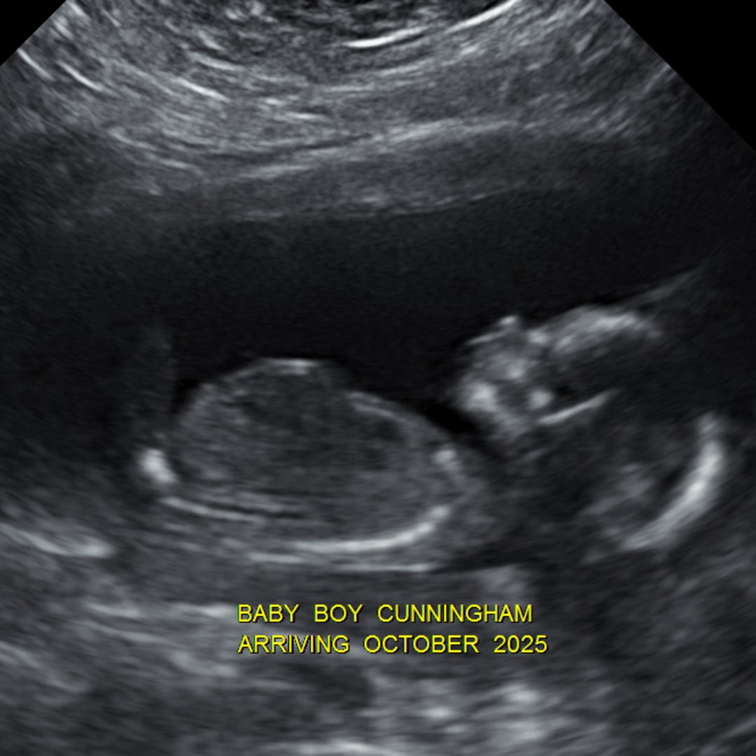 Photo shared by Katlyn for their Babylist baby registry.