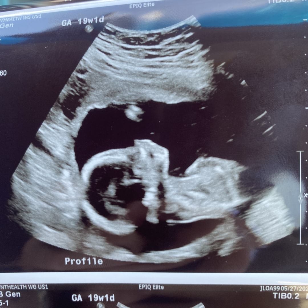 Photo shared by Amber for their Babylist baby registry.