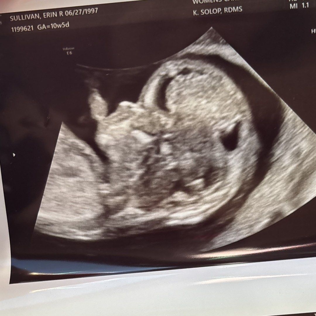 Photo shared by Erin for their Babylist baby registry.