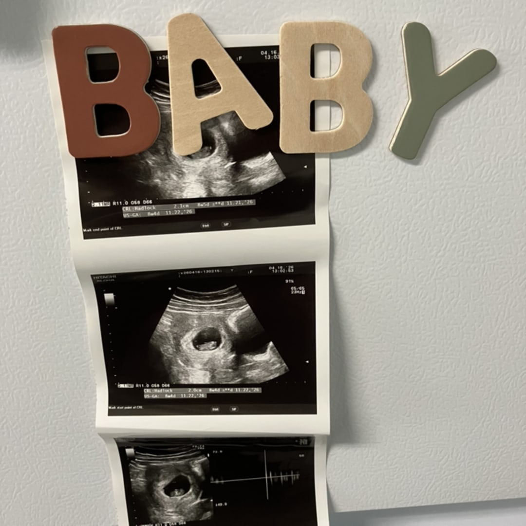 Photo shared by Becca (Rebecca) for their Babylist baby registry.