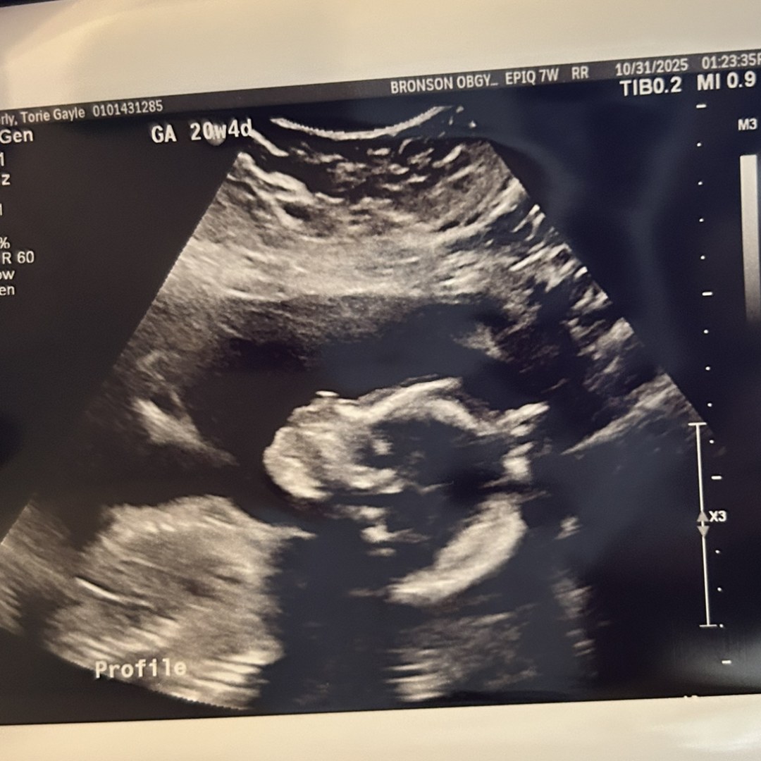 Photo shared by Torie for their Babylist baby registry.