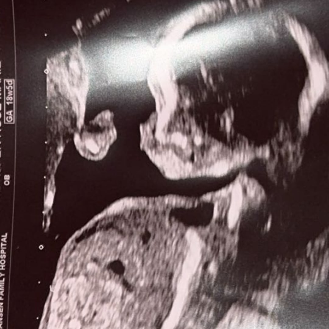 Photo shared by Aspen for their Babylist baby registry.