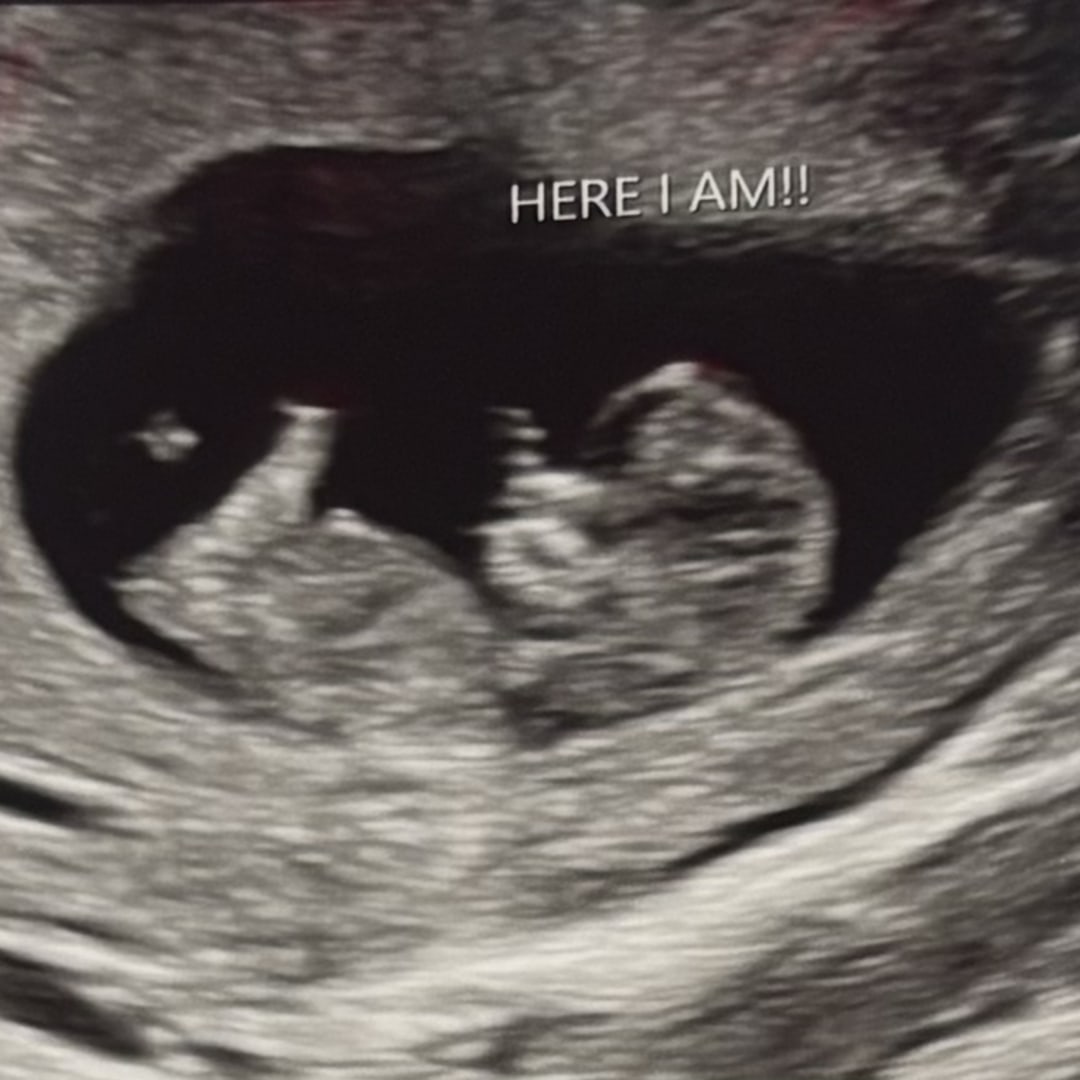 Photo shared by Lauren for their Babylist baby registry.