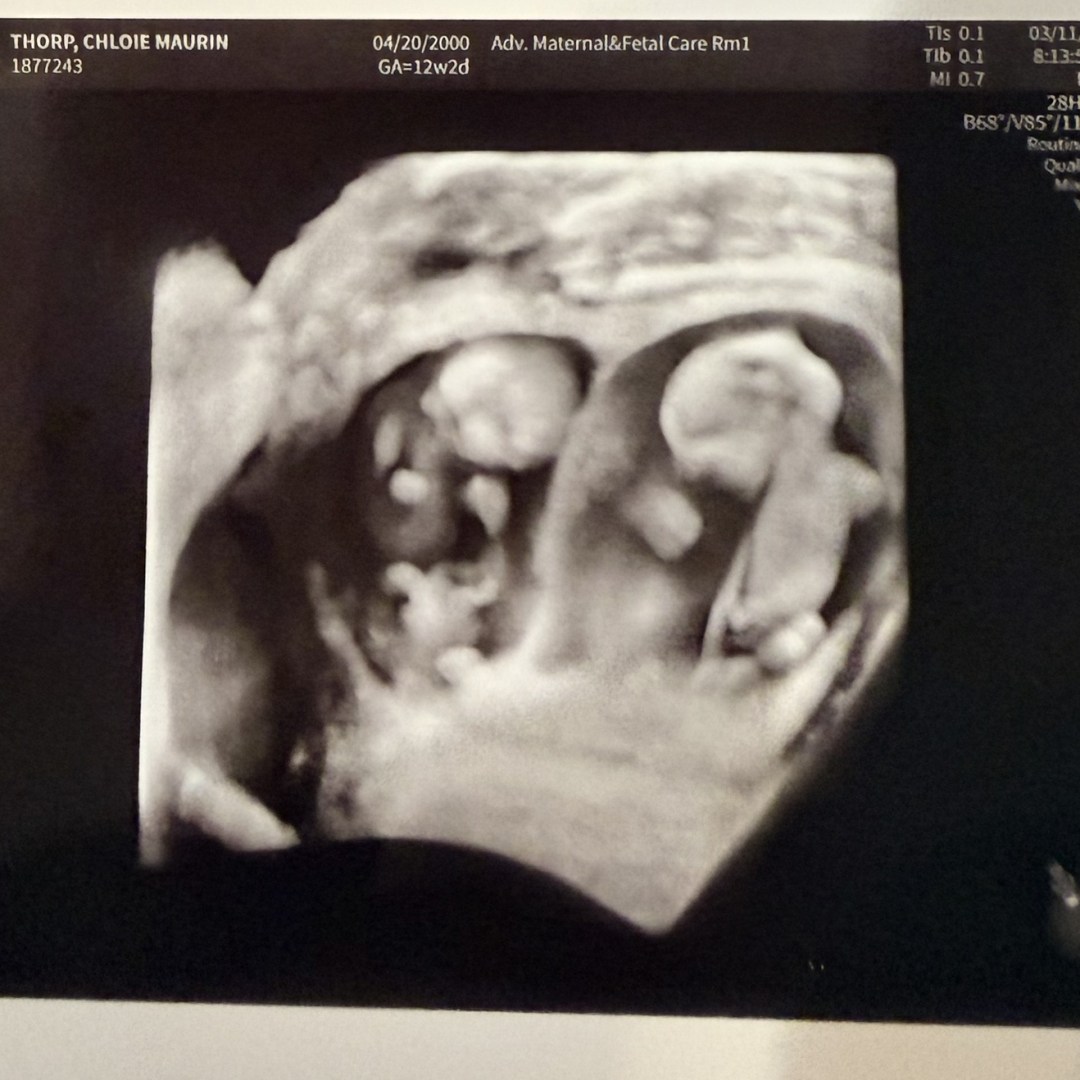 Photo shared by Chloie for their Babylist baby registry.